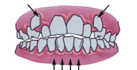 Tratamentul ortodontic