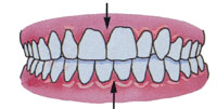 Tratamentul ortodontic