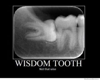 wisdom-tooth-not-that-wise