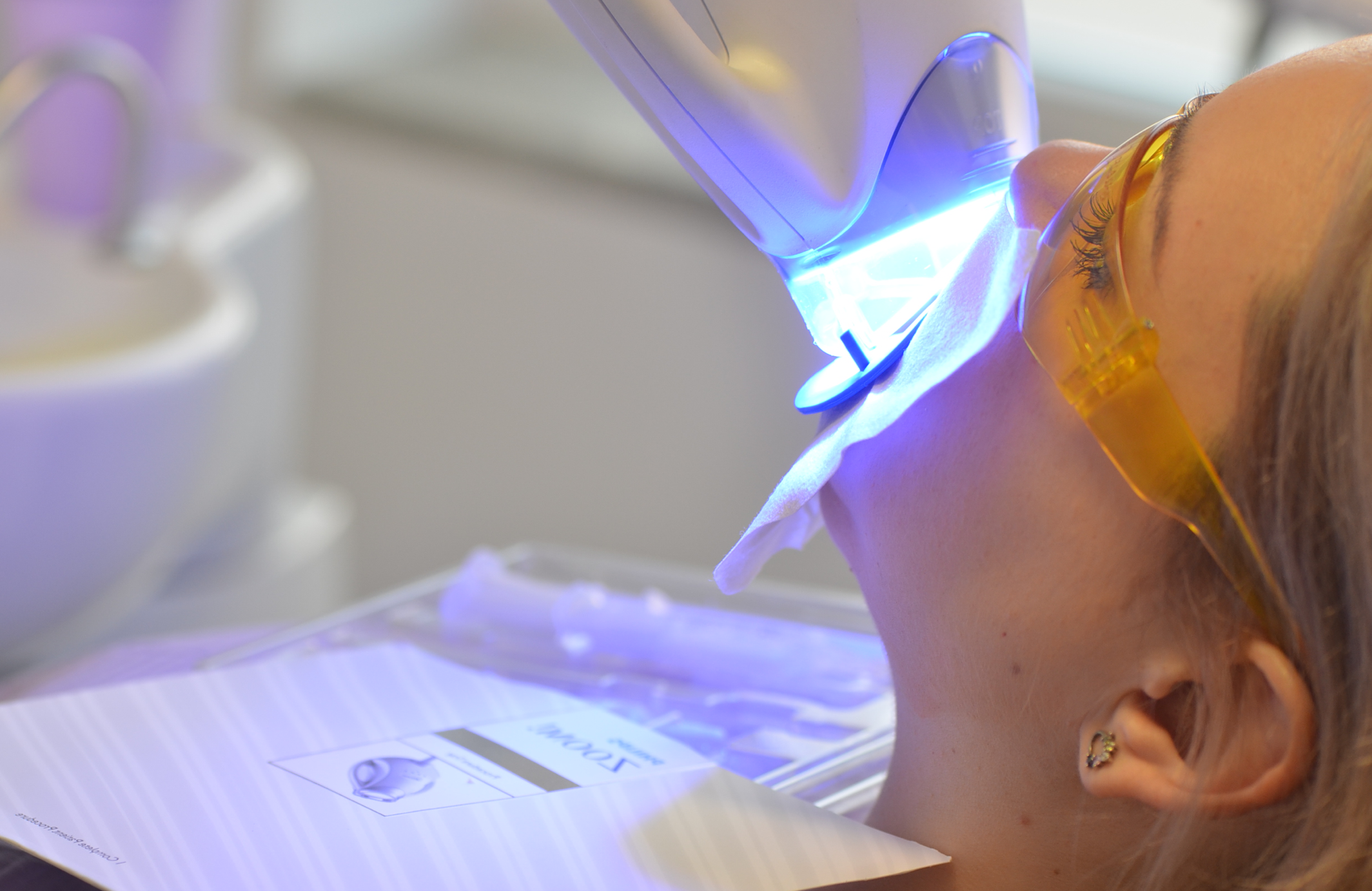 Tratament de albire dentara cu lampa Zoom Philips in cabinet