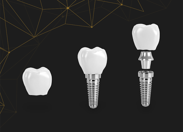 Implant dentar (fără coroană de ceramică)