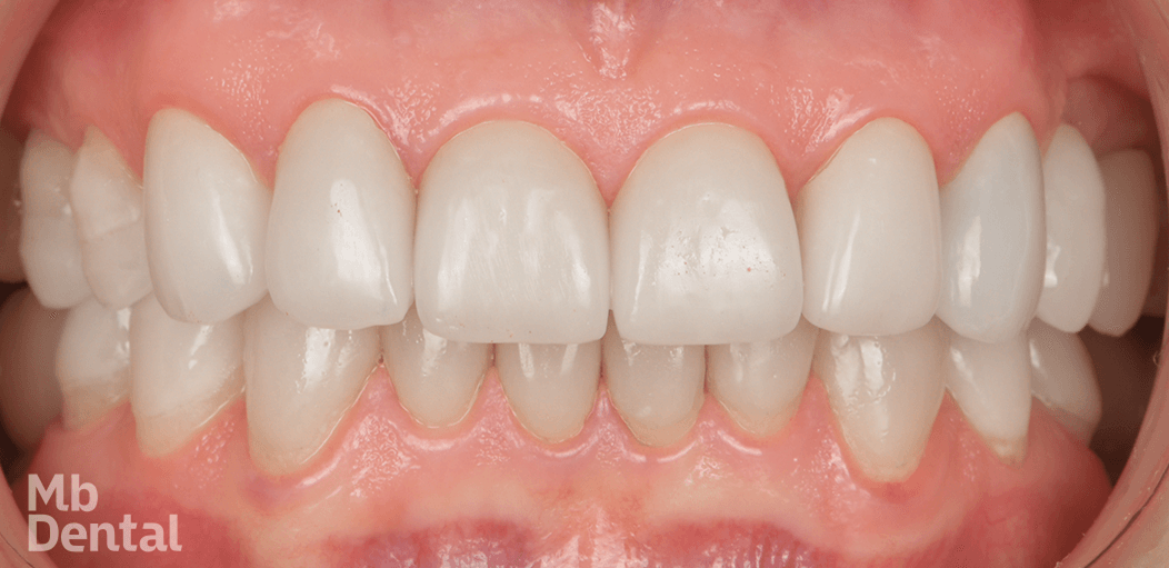 Rezultate stomatologie targu mures