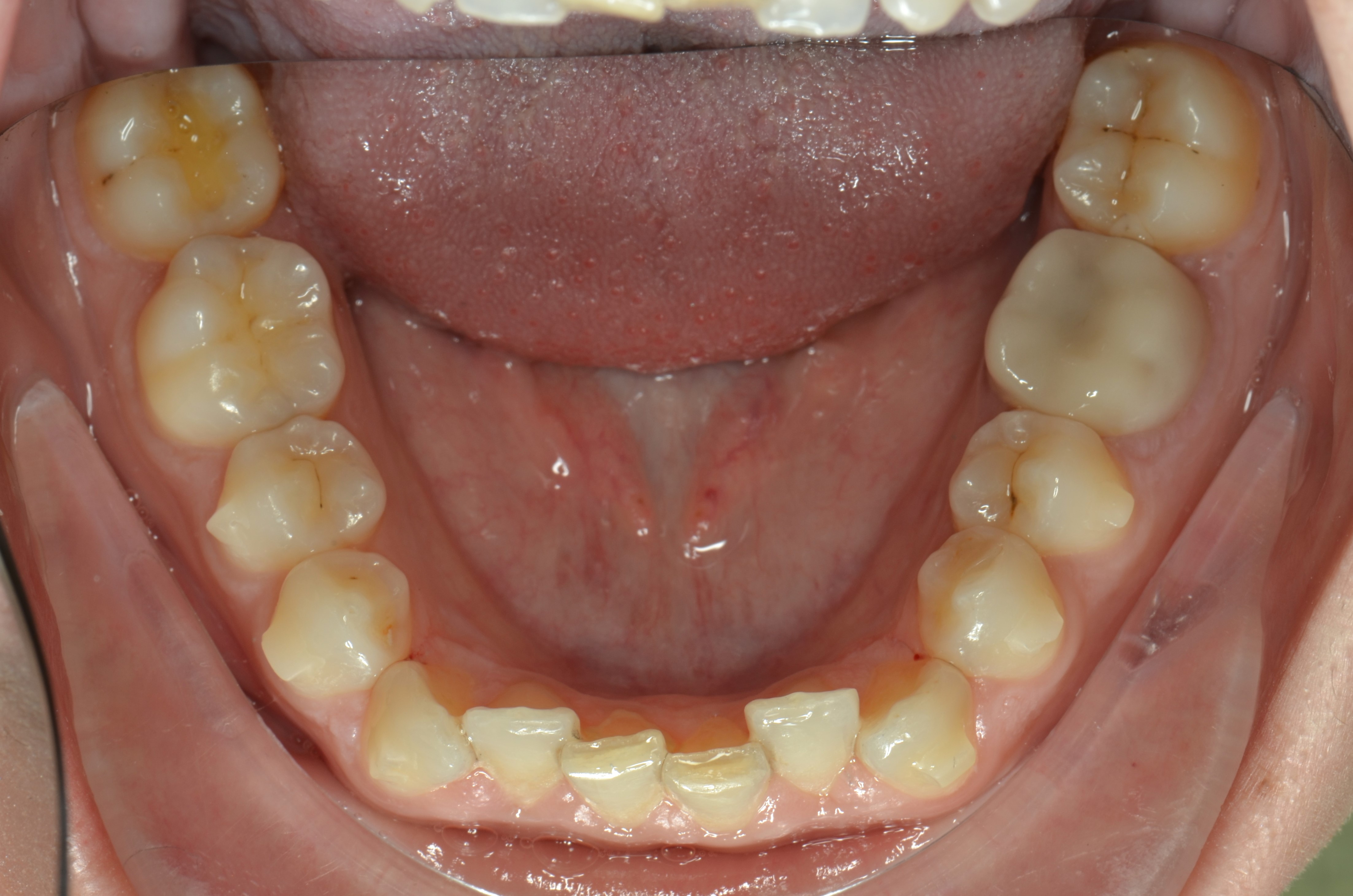 Figura 11