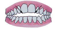 Tratamentul ortodontic
