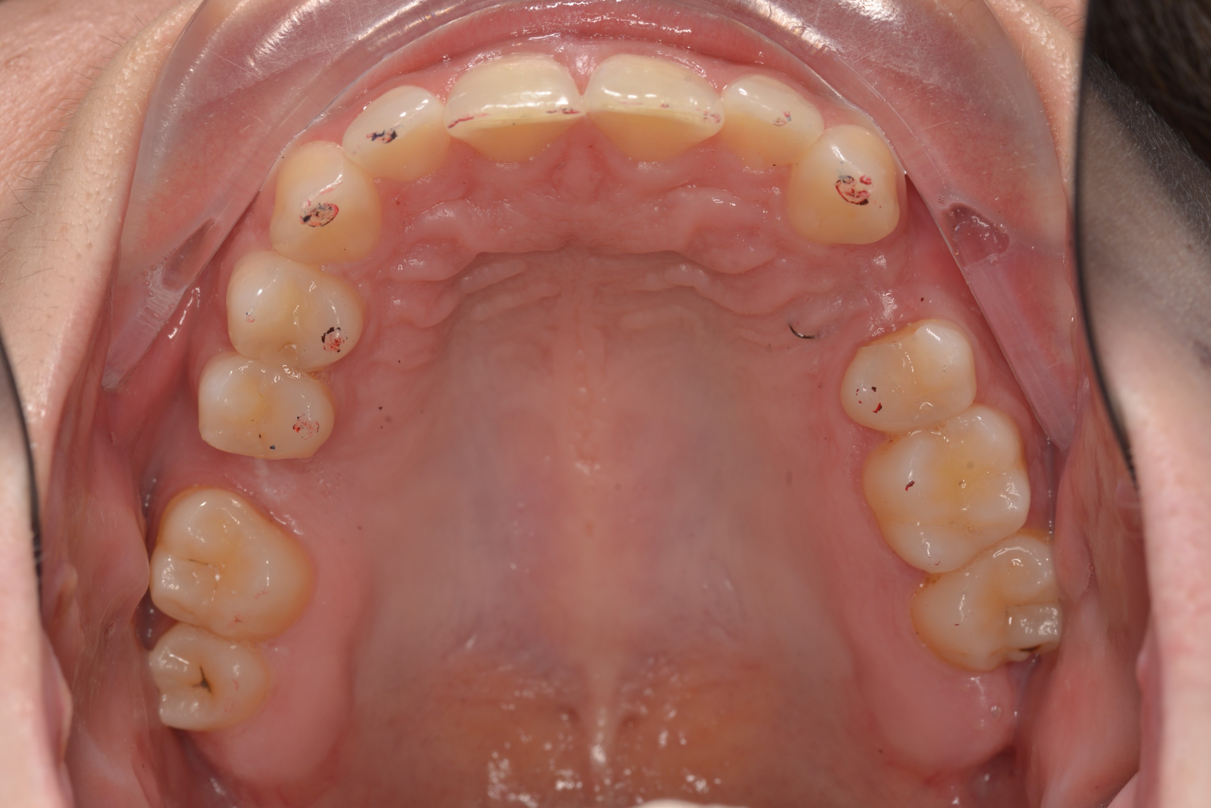 Figura 5