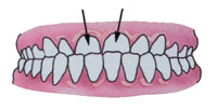 Tratamentul ortodontic