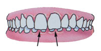 Tratamentul ortodontic