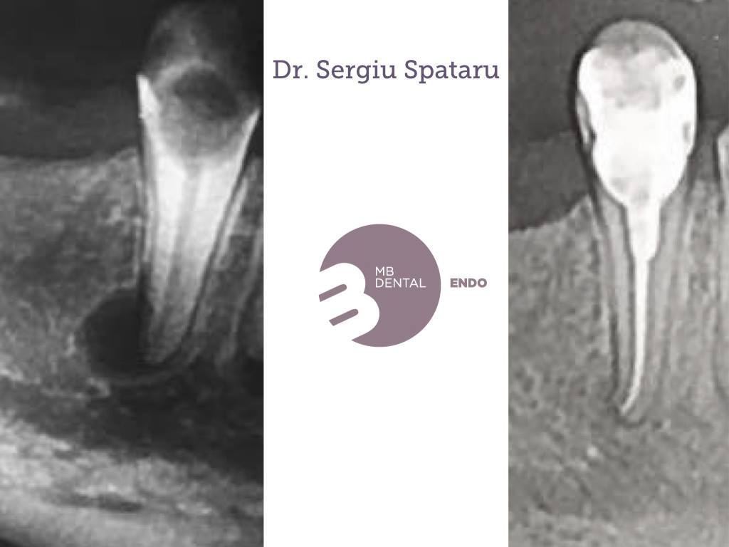 endodontie microscop