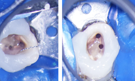 Figura 4.12.18, Figura 4.12.19