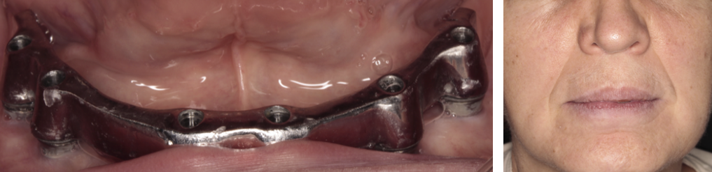 Figura 3.9.10, Figura 3.9.12