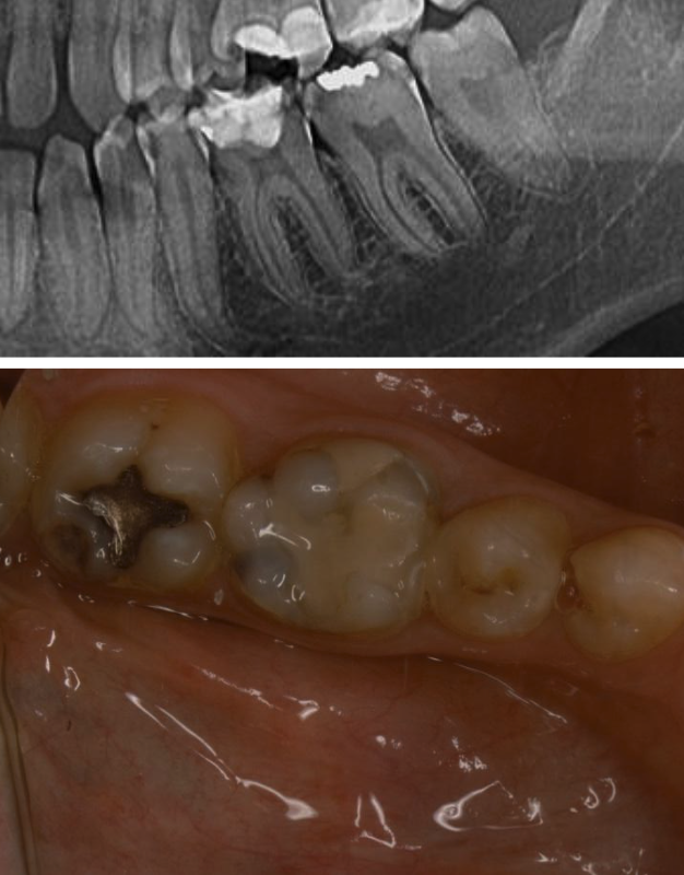 Figura 1. Examinarea inițială