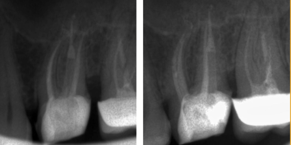 Figura 4.12.20, Figura 4.12.21