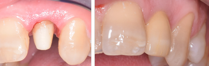 Figura 5.6.9 si 5.6.10