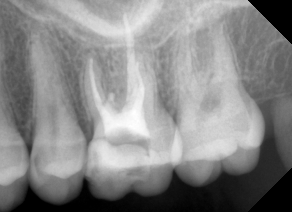 Figura 8. Radiografia de control