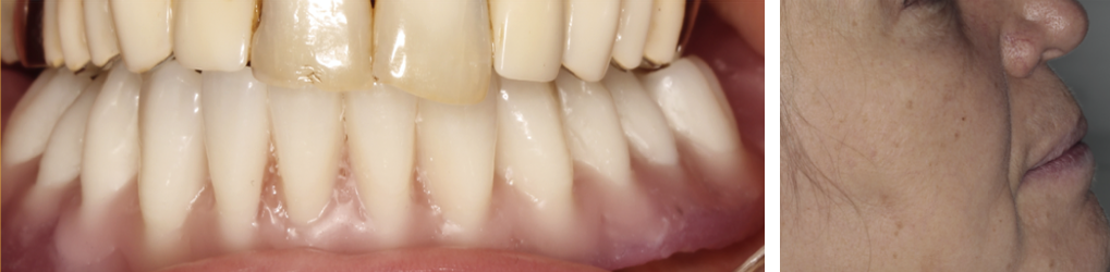 Figura 3.9.11, Figura 3.9.13