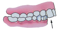 Tratamentul ortodontic