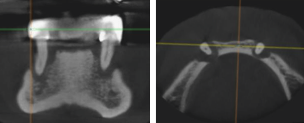Figura 3.9.1, Figura 3.9.2